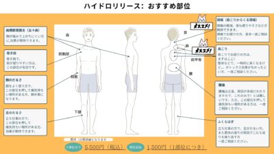 ハイドロリリース注射が効果的な部位8選｜五十肩・肩こり・腰痛・足のだるさの治療法のアイキャッチ画像
