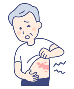 【50歳以上は要注意】帯状疱疹は予防すべき病気!その理由を医師が徹底解説のアイキャッチ画像