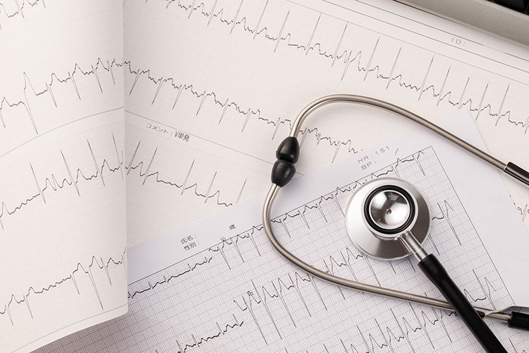 当院の検査方法