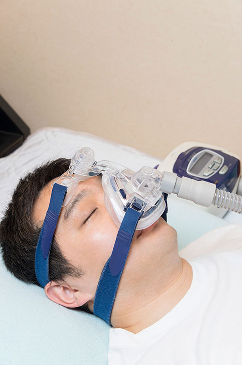 睡眠時無呼吸症候群の治療方法